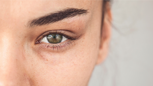 Woman with bright eyes after using BOTOX COSMETIC to treat dark circles